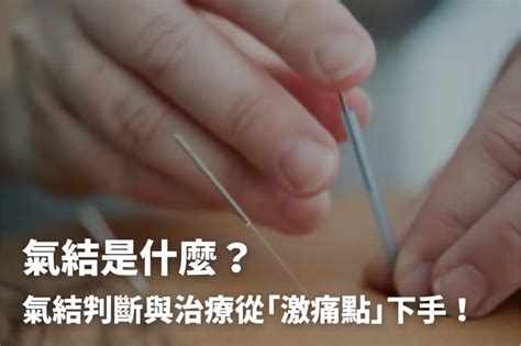 氣結|氣結是什麼？氣結判斷與治療從「激痛點」下手！